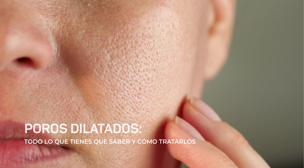 💡 Todo lo que Debes Saber sobre los Poros Dilatados y Cómo Tratarlos en Dear Skin MX